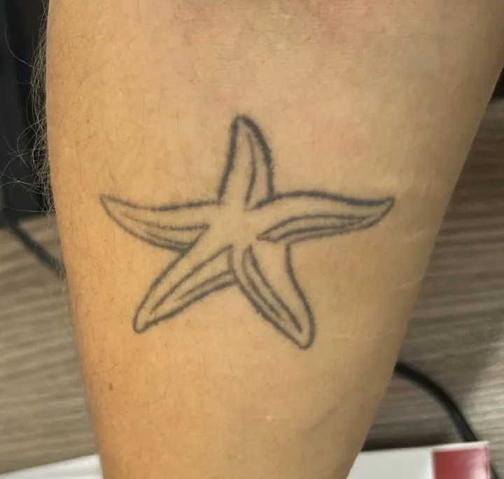 Cover-up, before: a starfish outline on the forearm
